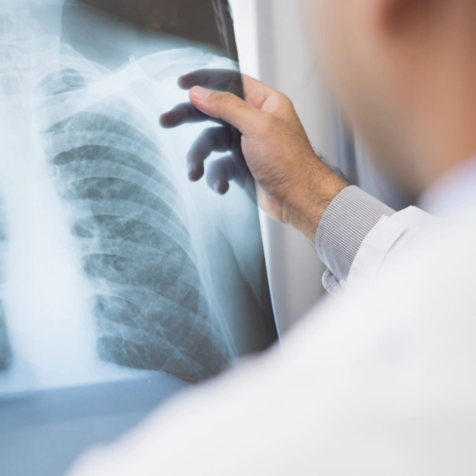 Doc looking at x-ray of patient with back pain